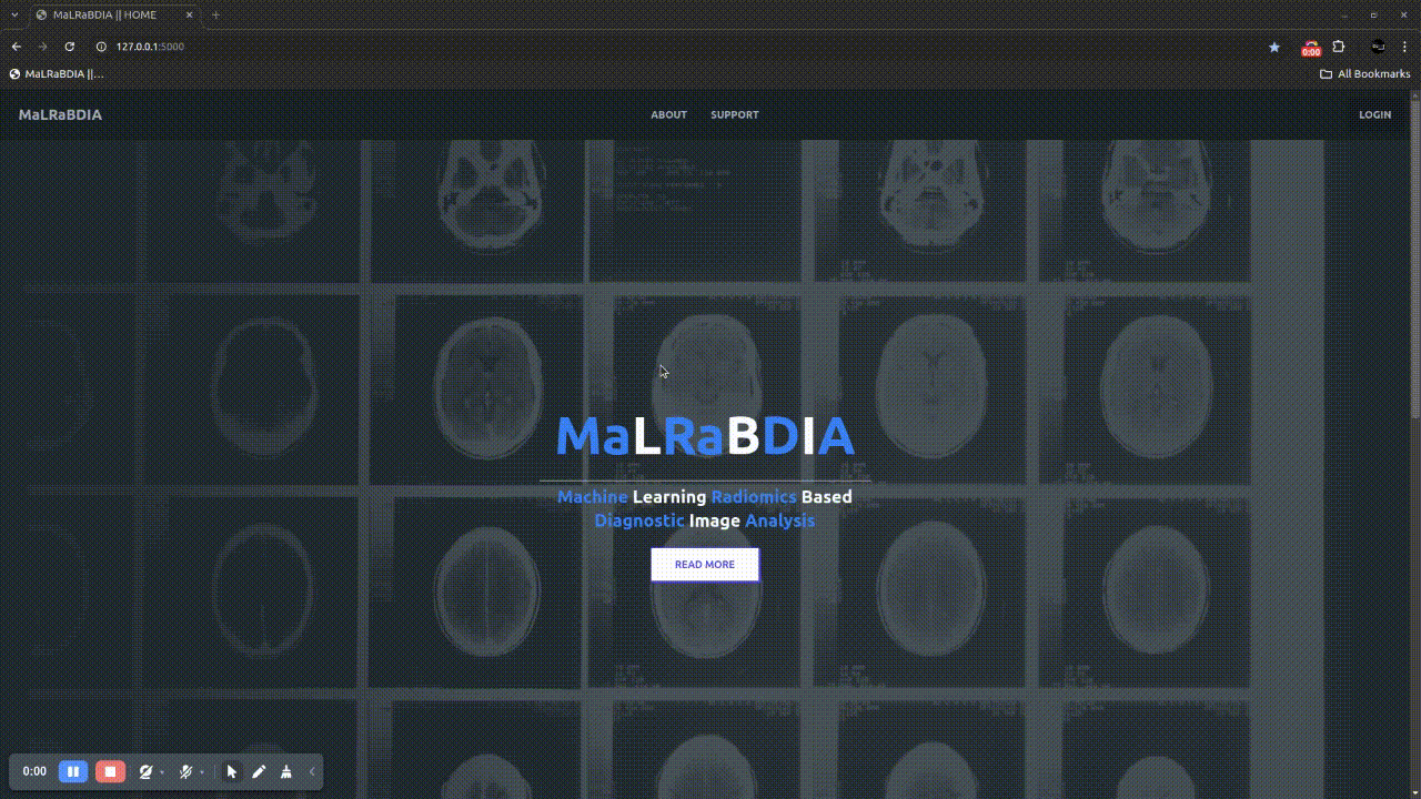 Computer-Aided Diagnosis of Hepatic Tumors Using Radiomics in Multi-Phase CT Images